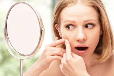 آکنه (جوش) چیست؟